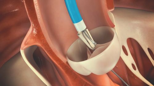 How Surgical Animation Improves Medical Communication and Training